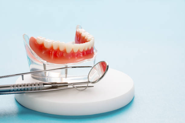 Full Mouth Reconstruction in Lake Mills, WI